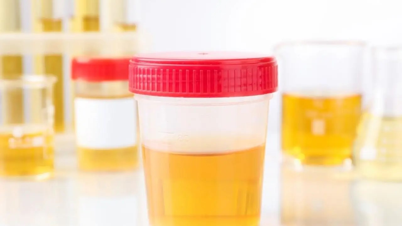 Una prueba de orina detecta más rápido el antibiótico más adecuado para las infecciones urinarias